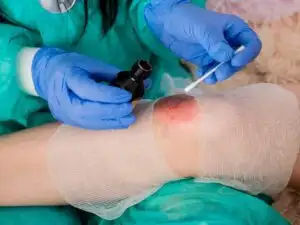Dressings for Wound Care