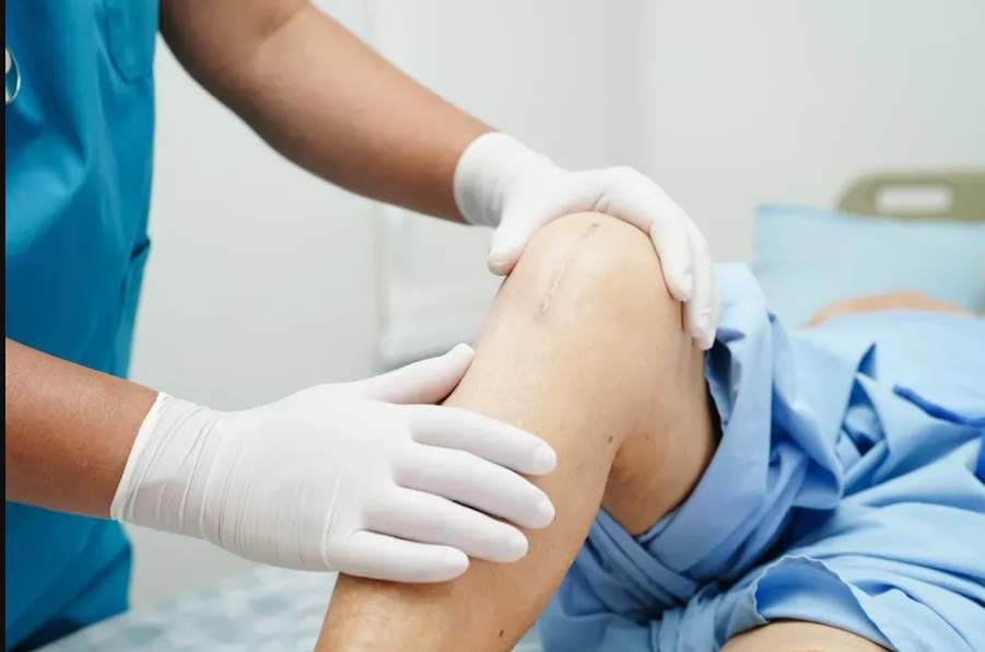 post surgery wound care tips