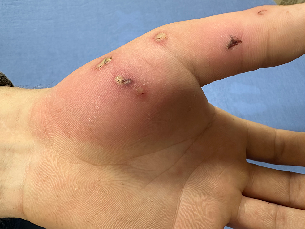 Dog Bite Wound Look Like