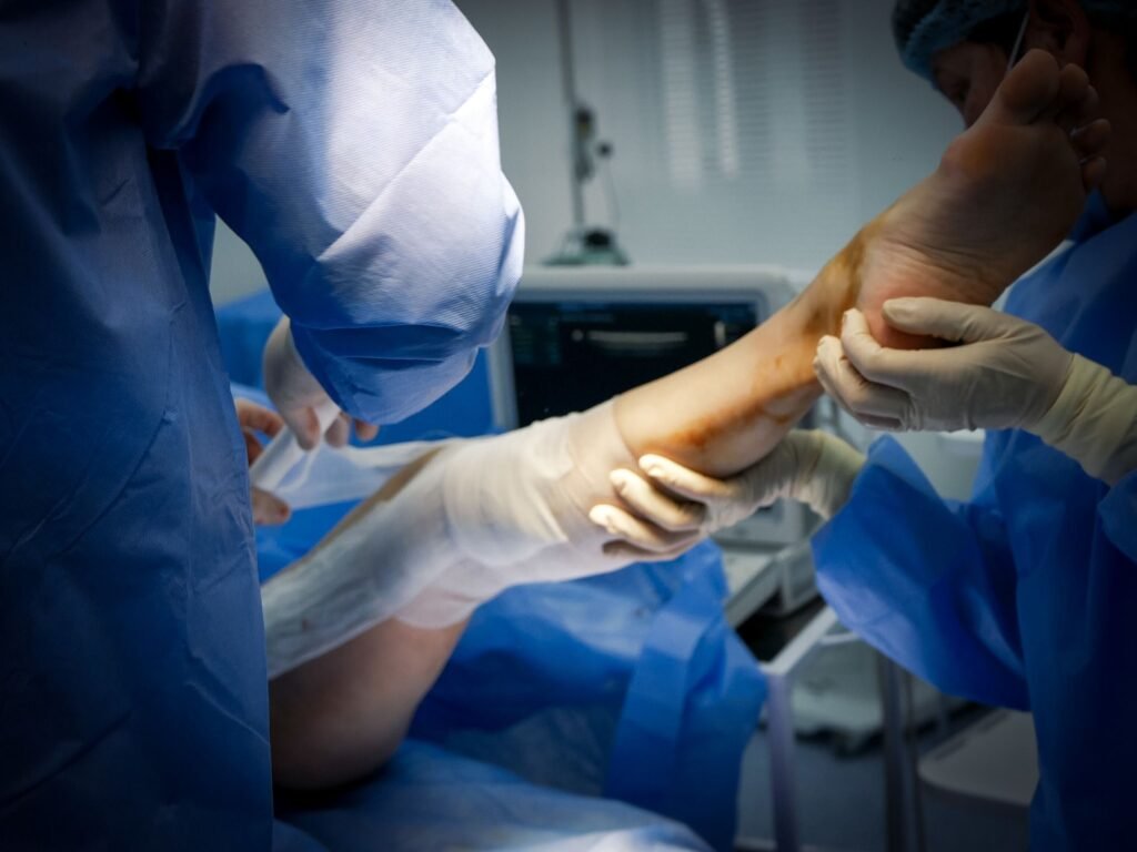 negative presssure wound therapy for diabetic ulcer